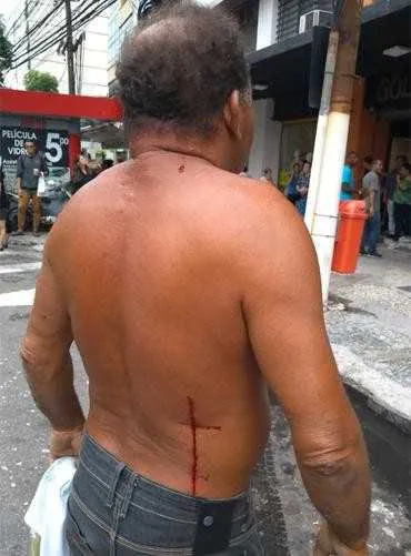 Homem teve ferimento nas costas