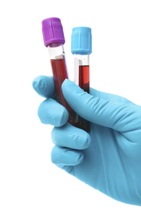 Laboratório fará várias análises clínicas laboratoriais