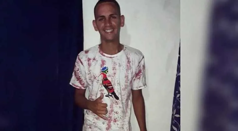 Rafael não resistiu as diversas queimaduras em seu corpo