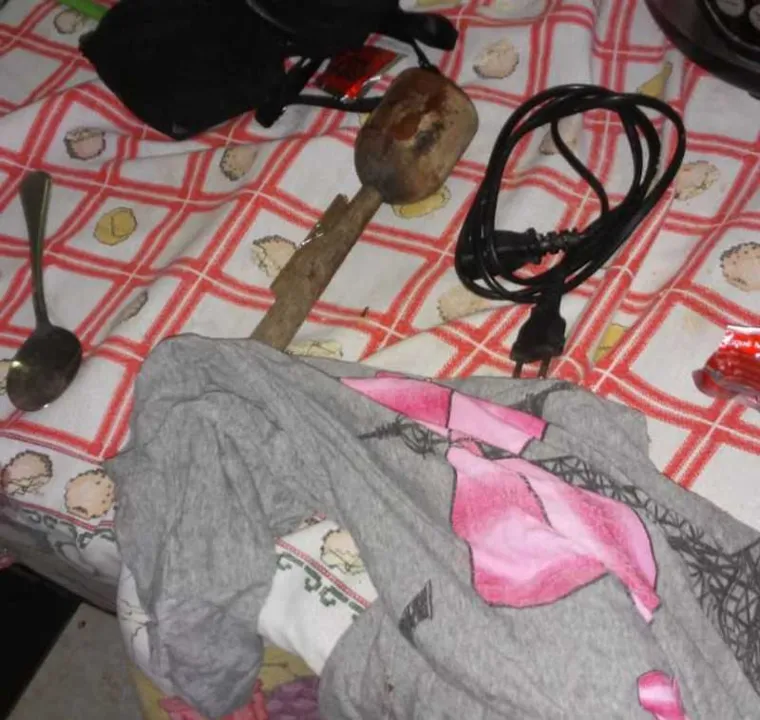 Vítima está internada na Santa Casa Misericórdia de Barra Mansa