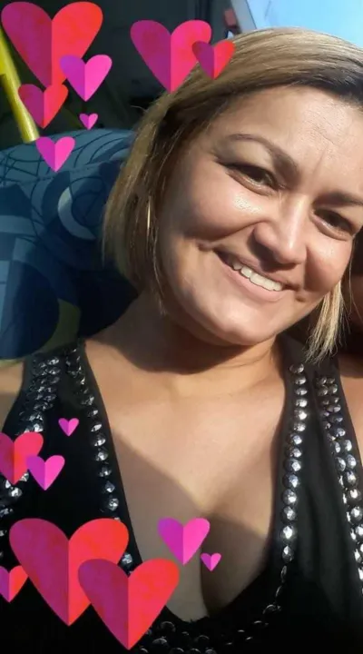 Tatiana sofreu uma grave lesão na perna