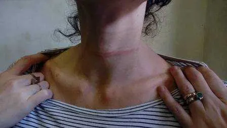 Ela viveu dois episódios de agressão pelo ex-marido em 2018