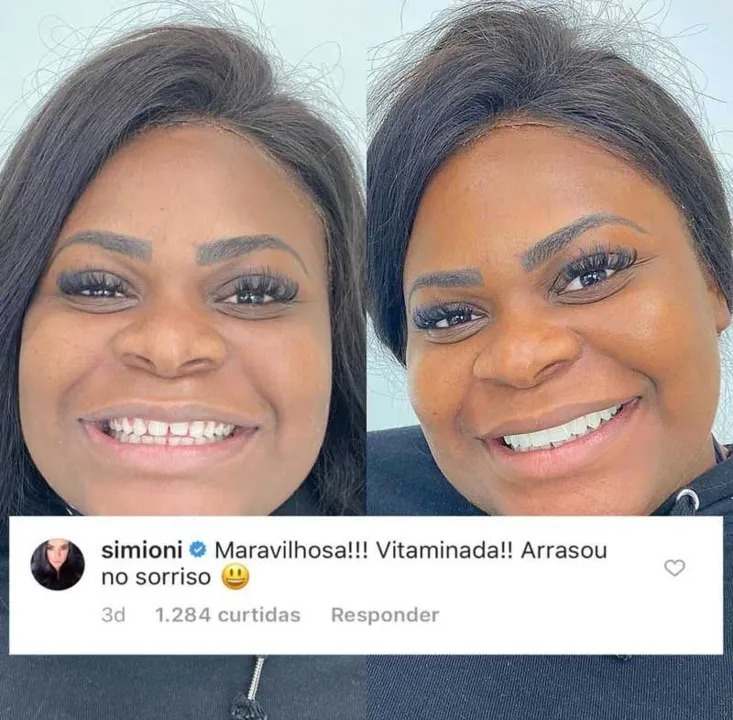 Simioni faz comentário debochado em foto de Jojo Toddynho 
