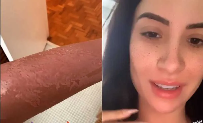 Ela confundiu protetor com bronzeador 