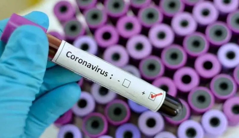 Imagem ilustrativa da imagem Secretaria de Saúde confirma sétimo e oitavo óbitos por coronavírus no estado do Rio