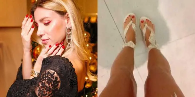 Imagem ilustrativa da imagem Influenciadora é criticada após dizer que está com 'perna de menina de rua'
