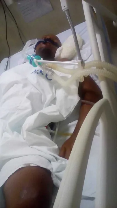 A vítima chegou a passar por uma cirurgia, mas o estado ainda é gravíssimo.