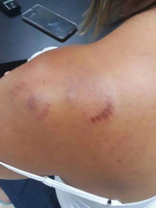 Ele foi autuado em flagrante por lesão corporal contra a ex-esposa