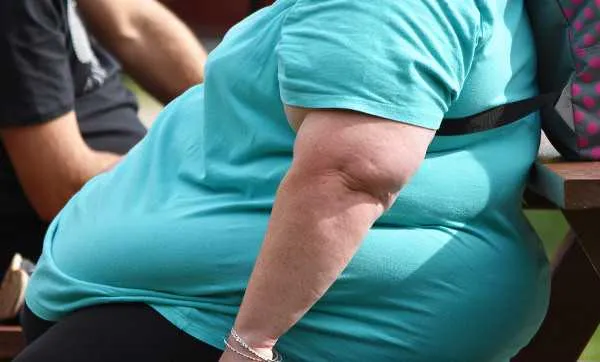 Imagem ilustrativa da imagem Obesidade afeta um em cada cinco brasileiros e aumenta risco de doenças graves