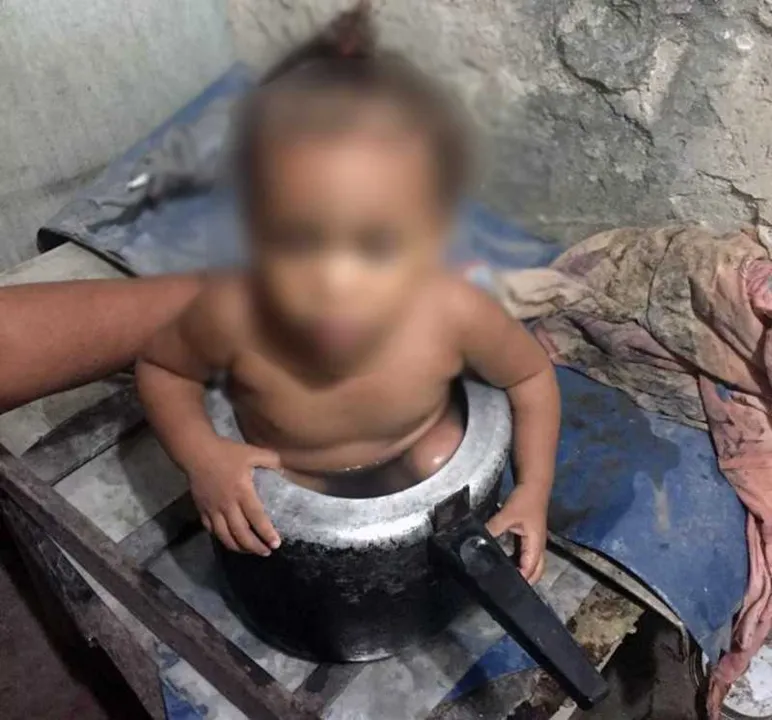 Criança estava brincando em casa e entrou na panela de pressão