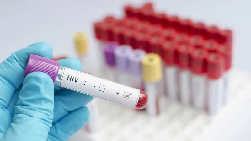 Imagem ilustrativa da imagem 135 mil brasileiros vivem com HIV e não sabem, diz pesquisa