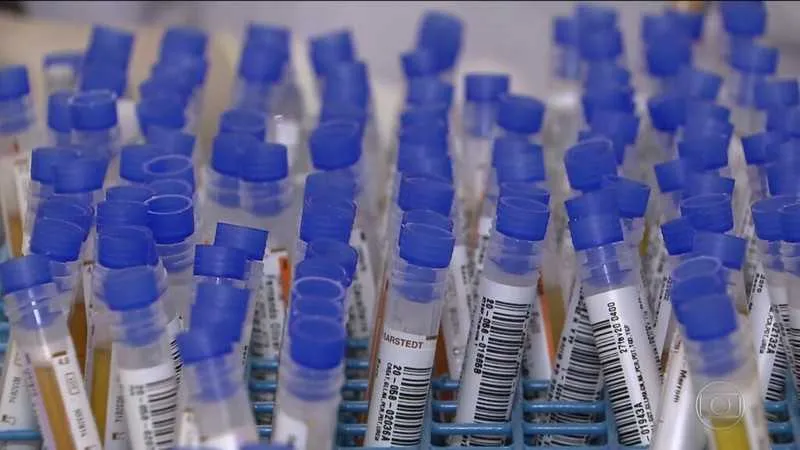 Imagem ilustrativa da imagem Petrobras doa 600 mil testes para diagnosticar Covid-19