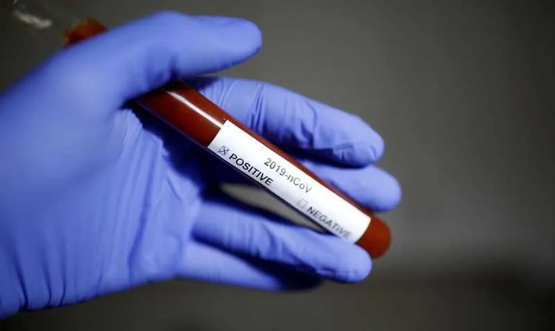 Os testes oficiais devem obter resultado em maio