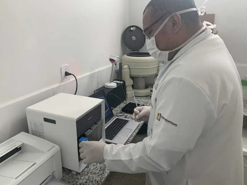 Resultados serão obtidos no mesmo dia do exame