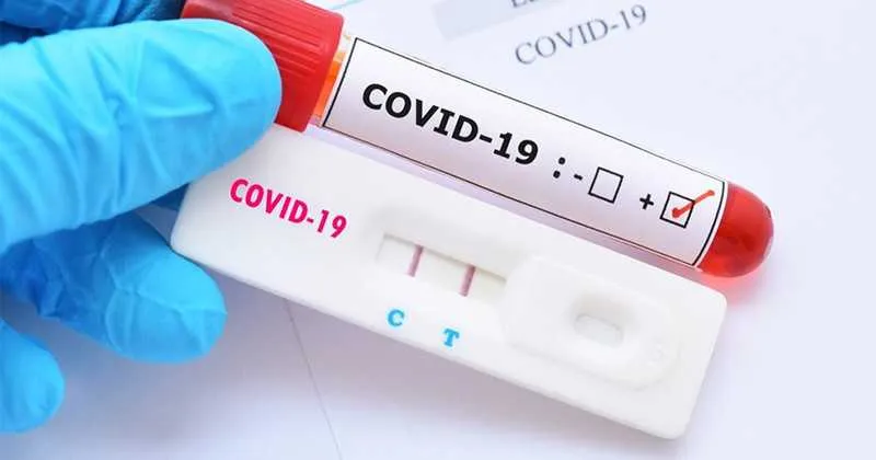 Imagem ilustrativa da imagem Testes de Covid-19 começam a ser aplicados em rodoviários em Niterói