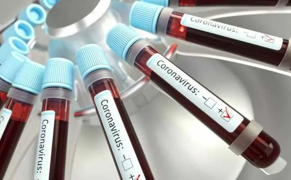 Empresa que desenvolve a vacina junto com a universidade pretende produzir mais de duas bilhões de doses