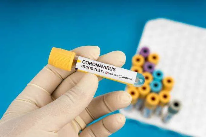 Foram registradas 11.519 mortes provocadas pela doença
