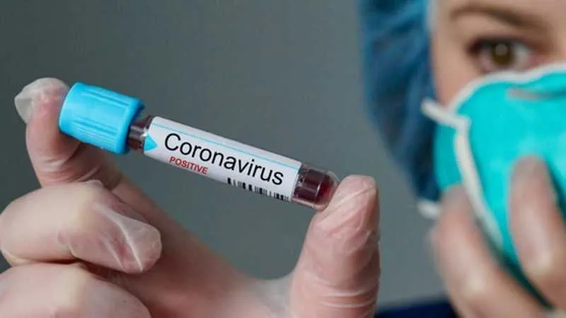 Imagem ilustrativa da imagem Estado do Rio passa de 80 mil casos confirmados de covid-19