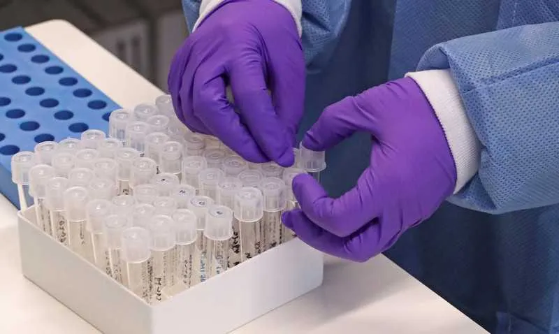 Município contabiliza 6397 casos suspeitos, 1008 confirmados, 565 descartados, 118 curados e 40 óbitos em investigação