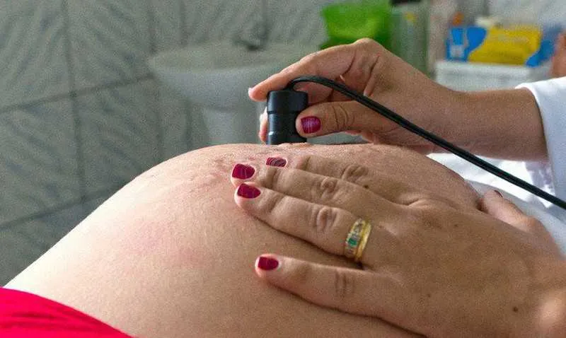 Imagem ilustrativa da imagem Lei que autoriza cesária sem motivo médico é inconstitucional, diz TJ