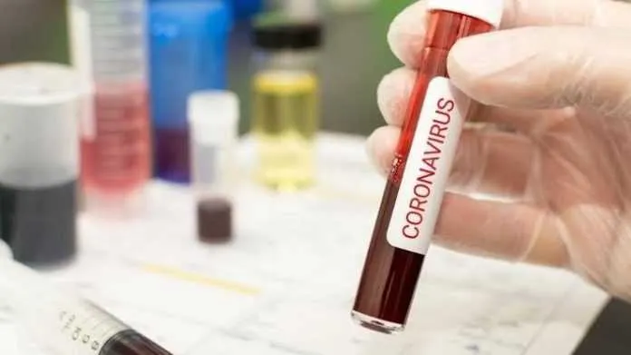 Exames estão sendo feitos pelo Laboratório Central de Saúde Pública Noel Nutels (Lacen)