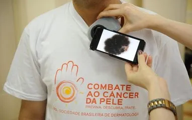 Imagem ilustrativa da imagem Servidor terá folga para exame preventivo de câncer