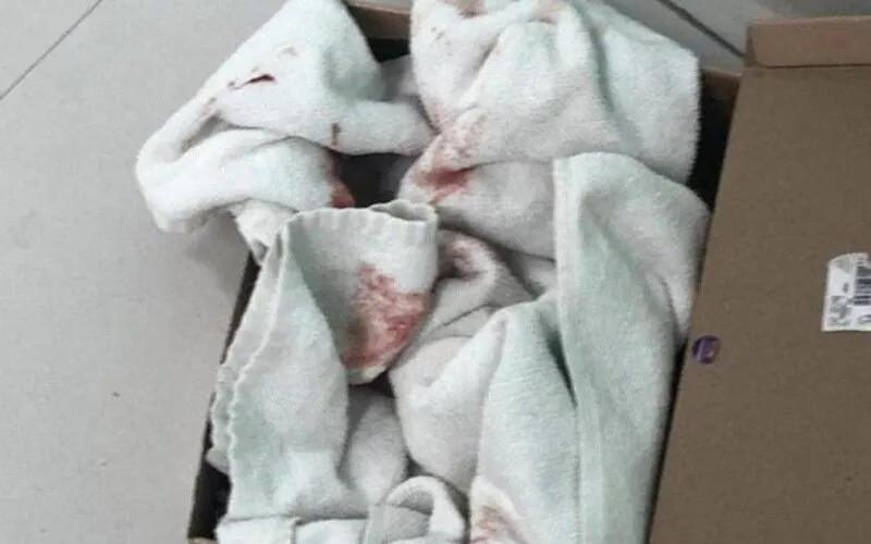  A criança ainda está internada na Unidade de Terapia Intensiva (UTI) neonatal, e seu quadro de saúde é estável