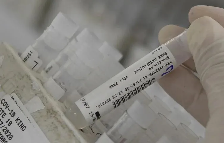 Ao todo, 192.681 pessoas morreram pelo infecção do novo vírus.